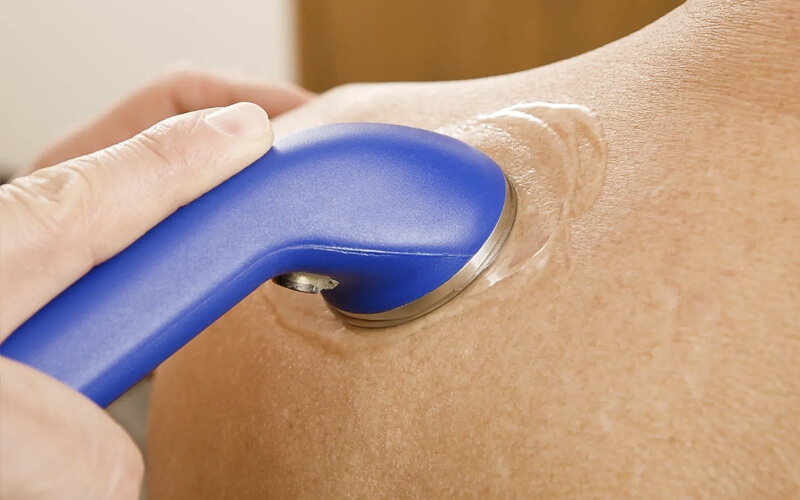 Electrotherapy Ultrasound Treatment